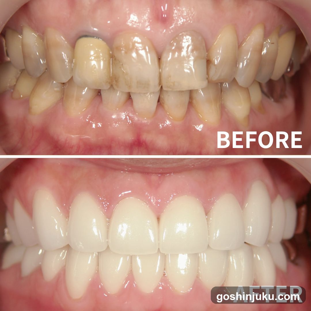 Before and After Dental Treatment