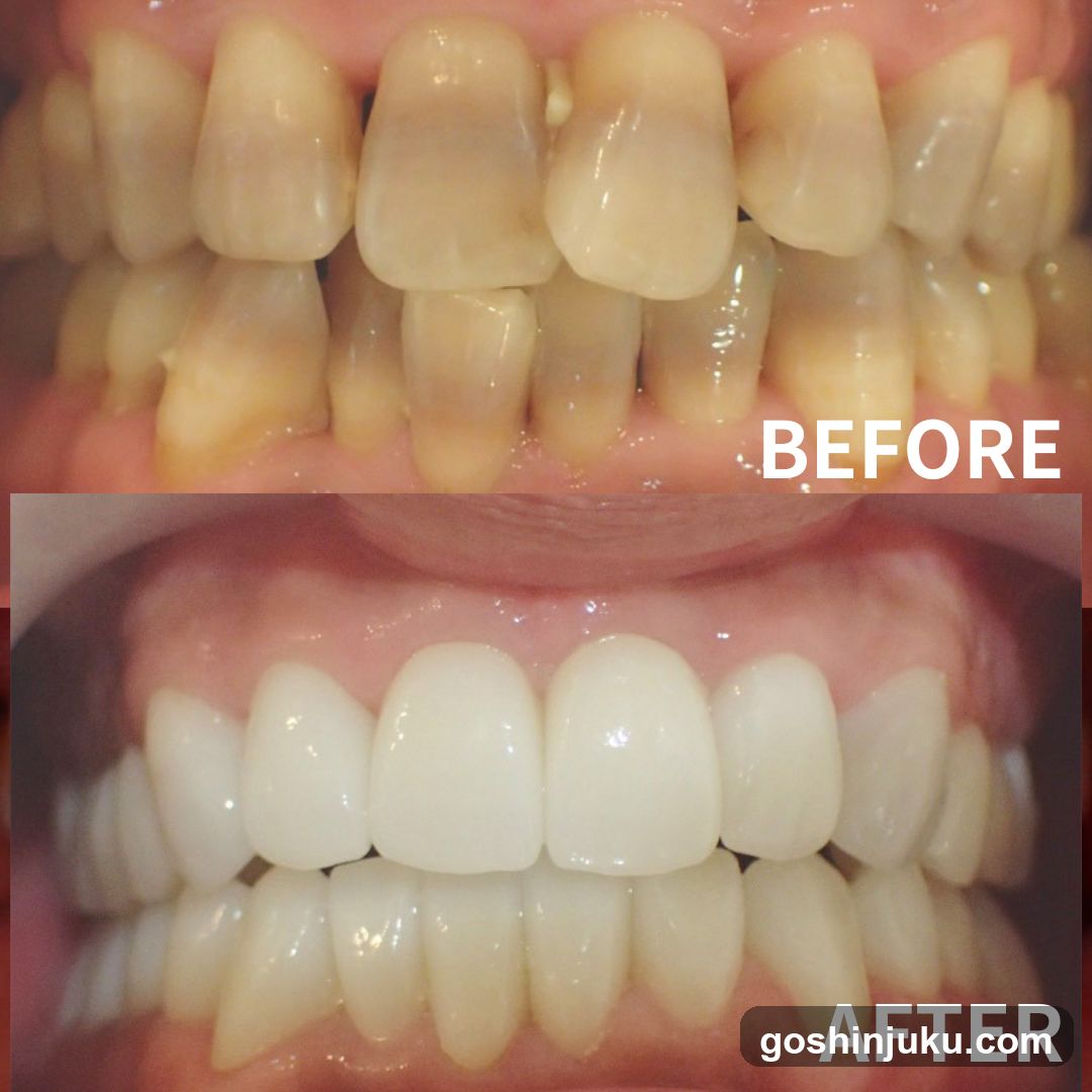 Dental Treatment Before and After