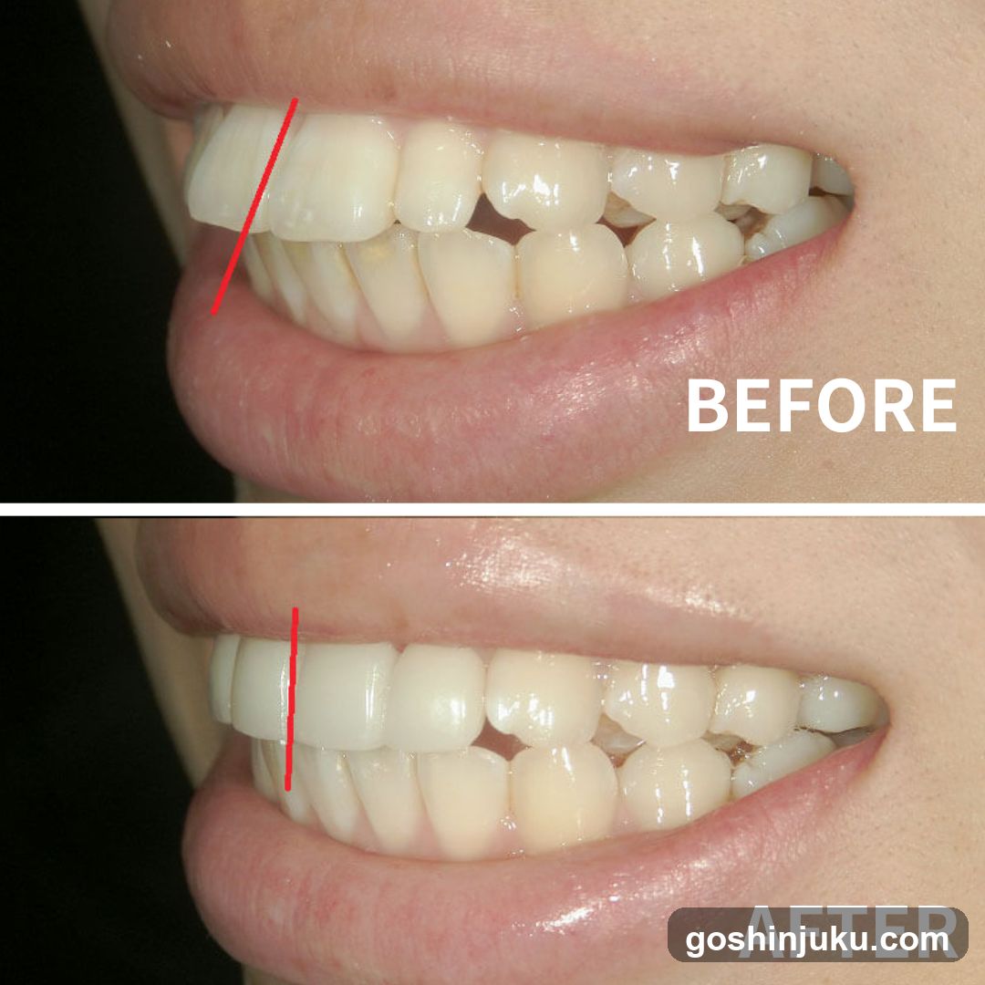 Dental Before and After