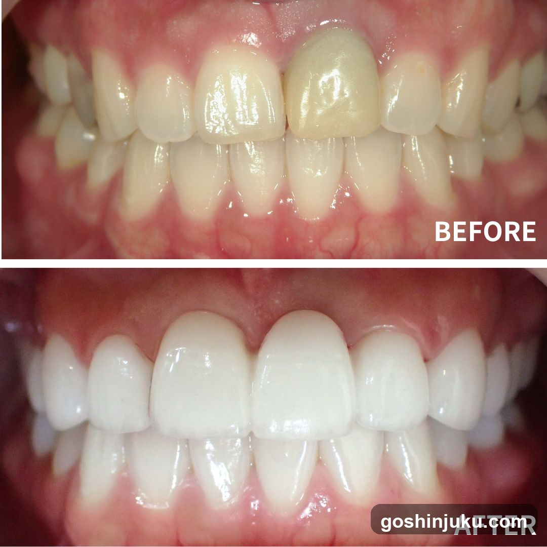 Dental Before and After Comparison